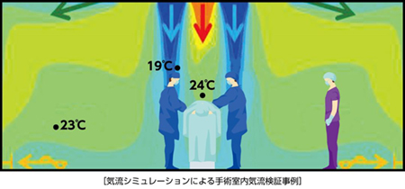 手術室の気流シミュレーション